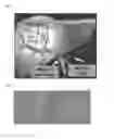 Fig. 02 - Vascular intervention robot and vascular intervention system