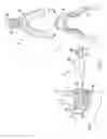 Fig. 02 - System and method for correcting malocclusion
