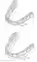 Fig. 01 - Aligners with enhanced gable bends
