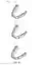 Fig. 03 - Aligners with enhanced gable bends