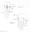 Fig. 03 - ANCHORING SYSTEM FOR PROSTHETICS