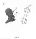 Fig. 02 - Jaw motion tracking system and operating method using the same