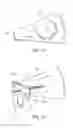 Fig. 08 - Device for the delivery of a prosthetic implant and method of use thereof
