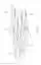 Fig. 16 - Implantable areal device for supporting tissue