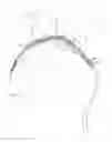 Fig. 01 - CATHETER-BASED APPARATUSES AND METHODS