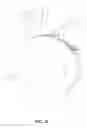 Fig. 11 - CATHETER-BASED APPARATUSES AND METHODS