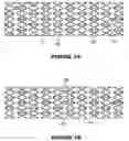 Fig. 02 - Medical device