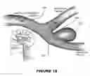 Fig. 14 - Medical device
