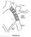Fig. 15 - Medical device
