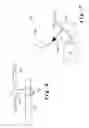 Fig. 06 - INTRAOCULAR LENS INJECTOR CONTROL SYSTEM