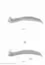 Fig. 05 - NASAL PROSTHESIS AND METHOD FOR MANUFACTURING THE SAME