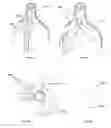 Fig. 06 - Heart valve support device and methods for making and using the same