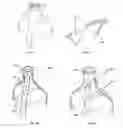 Fig. 07 - Heart valve support device and methods for making and using the same