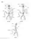 Fig. 35 - Heart valve support device and methods for making and using the same