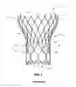 Fig. 02 - Sealing structures for paravalvular leak protection