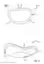 Fig. 02 - Annuloplasty ring for receiving a replacement valve