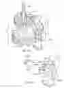 Fig. 11 - Covered heart valve sizer