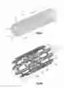 Fig. 02 - Expandable bone implant