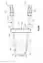 Fig. 09 - Expandable bone implant