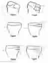 Fig. 22 - Expandable bone implant