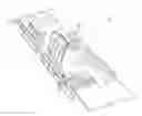 Fig. 01 - PATIENT-SPECIFIC ACETABULAR ALIGNMENT GUIDES