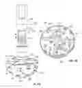 Fig. 06 - PATIENT-SPECIFIC ACETABULAR ALIGNMENT GUIDES