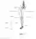 Fig. 02 - Systems and methods for joint replacement