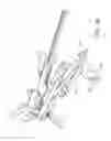 Fig. 49 - Systems and methods for joint replacement