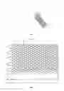 Fig. 02 - Intravascular stent, preparation method and use thereof