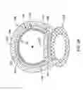 Fig. 04 - Endoluminal stents and methods of delivery