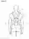 Fig. 07 - Conforming rigid cast, brace and splint comprising a curable polymeric material