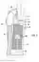 Fig. 06 - Thumb Rehabilitation Splinting Device