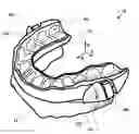 Fig. 01 - Occlusal splint arrangement