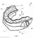 Fig. 02 - Occlusal splint arrangement