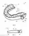 Fig. 04 - Occlusal splint arrangement