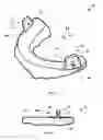 Fig. 08 - Occlusal splint arrangement