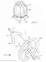 Fig. 02 - Tissue retention devices and systems and methods for implanting and using them