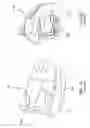 Fig. 02 - Methods and devices for treating sleep apnea