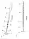 Fig. 04 - Methods and devices for treating sleep apnea