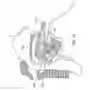 Fig. 22 - Methods and devices for treating sleep apnea