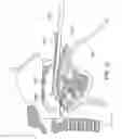 Fig. 23 - Methods and devices for treating sleep apnea