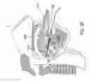 Fig. 28 - Methods and devices for treating sleep apnea