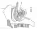 Fig. 32 - Methods and devices for treating sleep apnea
