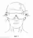 Fig. 02 - Depth filter for visual prostheses