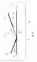 Fig. 07 - Wound closing bandage