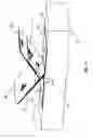 Fig. 15 - Wound closing bandage