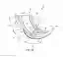 Fig. 99 - Laminate(S) Comprising Beamed Elastics and Absorbent Article(S) Comprising Said Laminate(S)