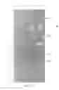 Fig. 13 - Shaped nonwoven