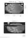 Fig. 30 - Shaped nonwoven
