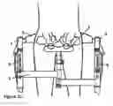 Fig. 04 - Mobility assistance device